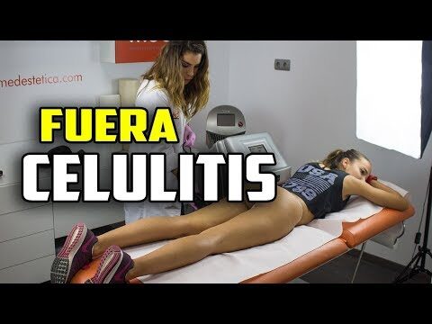Eliminación de celulitis: Cavitación eficaz